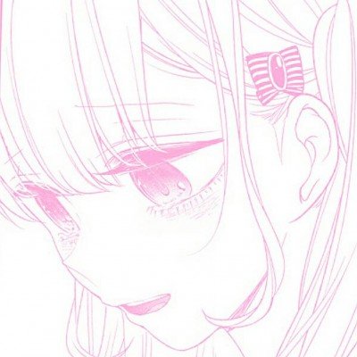 11岁女孩患肝衰竭和白血病双眼变绿